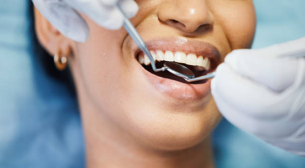 Best Emergency Treatment for Dental Infections or Abscesses in Sultana, CA