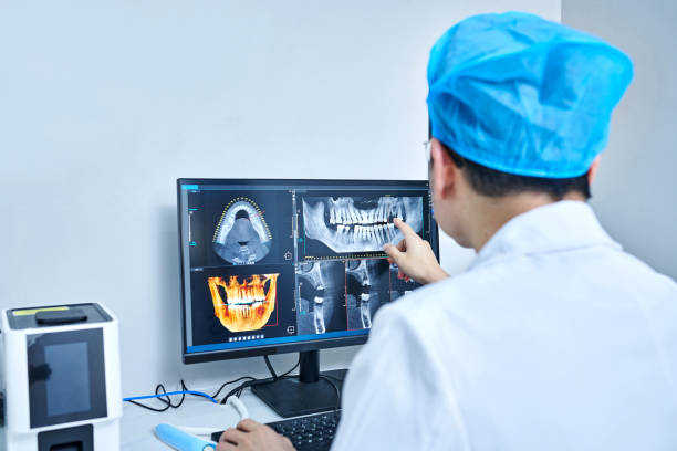 Best Emergency Wisdom Teeth Removal in Sultana, CA